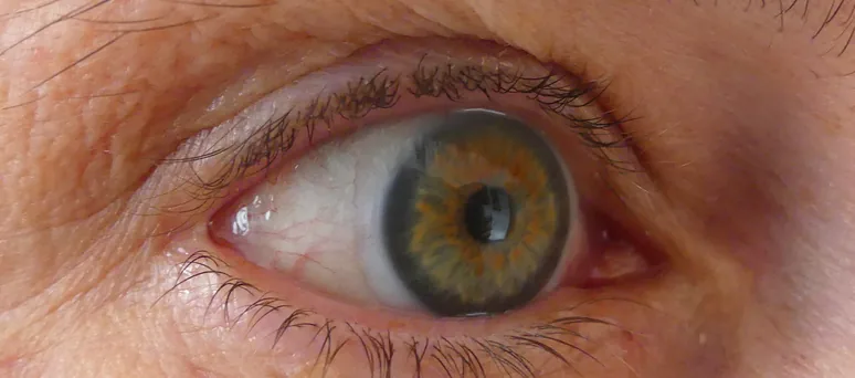 Contact lens on a fingertip